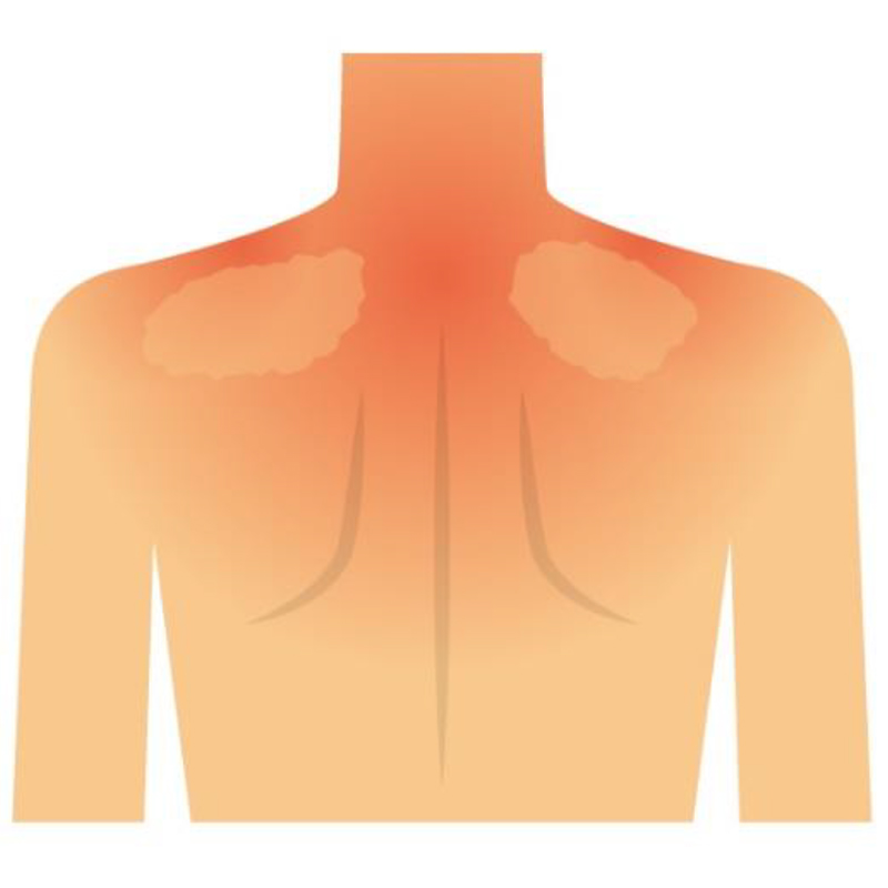 姿勢不良による、背中の筋肉への負担
